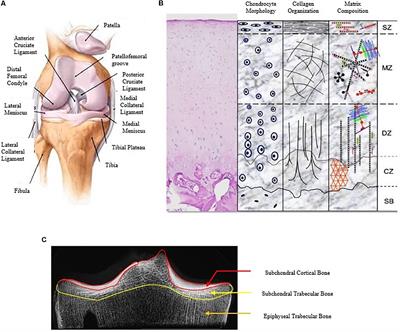 Use of Computational Modeling to Study Joint Degeneration: A Review